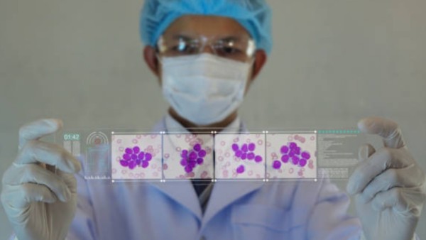 Mereka berhasil menciptakan model laboratorium yang bisa meniru perkembangan penyakit dari tahap ringan hingga jadi sangat agresif, khususnya pada kasus myelodysplastic syndrome (MDS) yang sering berkembang menjadi acute myeloid leukemia (AML).