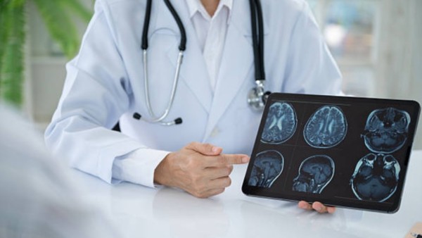Lebih dari 8 juta orang di seluruh dunia saat ini hidup dengan Parkinson, penyakit otak progresif yang ditandai dengan tremor, otot kaku, gerakan melambat, hingga kesulitan menjaga keseimbangan.