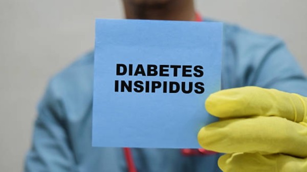 Berbeda dengan diabetes mellitus (tipe 1 dan 2) yang disebabkan oleh masalah insulin, diabetes insipidus terjadi karena gangguan pada hormon arginine vasopressin (AVP), atau dikenal juga sebagai antidiuretic hormone (ADH).
