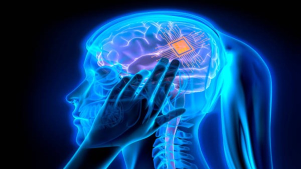 Ilustrasi chip otak manusia yang dikembangkan untuk mengembalikan penglihatan dan kendali tubuh dengan pikiran. (Foto: iStockphoto)